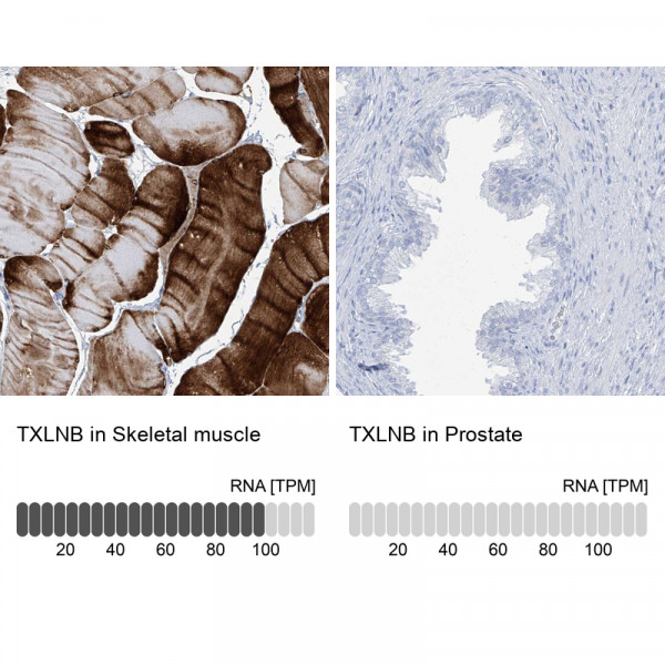 Anti-TXLNB