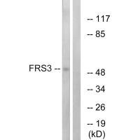 Anti-FRS3