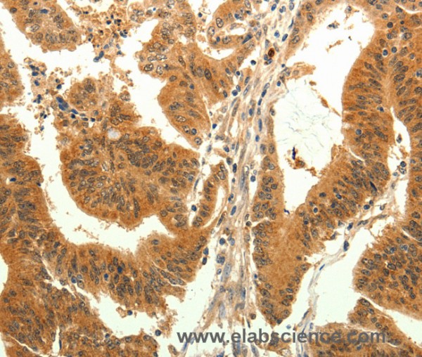 Anti-TRPM7