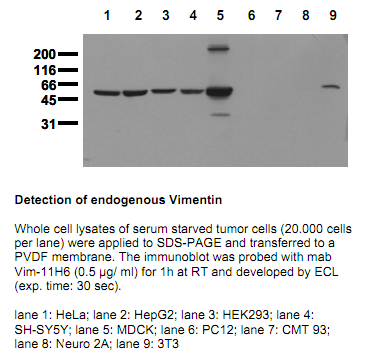 Anti-Vimentin, clone 11H6