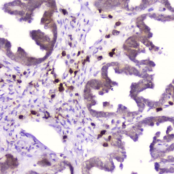 Anti-RNASE3 / Eosinophil cationic protein