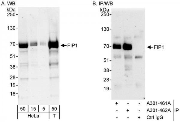 Anti-FIP1