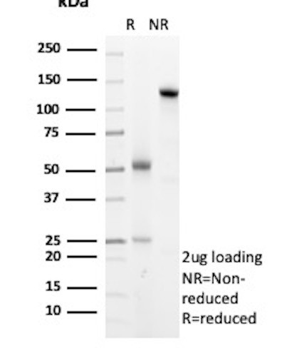 Anti-Arginase 1 (Hepatocellular Carcinoma Marker), recombinant antibody, clone ARG1/8869R