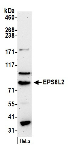 Anti-EPS8L2