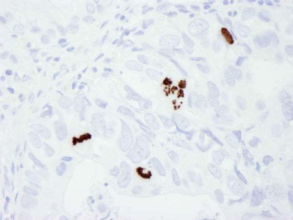 Anti-phospho-Histone H3 (Ser10) (IHC)