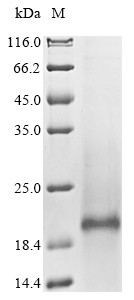 Solute carrier organic anion transporter family member 2B1 (SLCO2B1), partial, human, recombinant