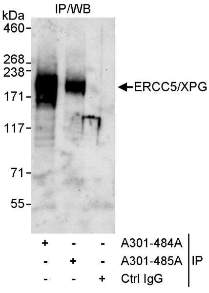 Anti-ERCC5/XPG