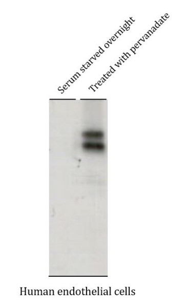 Anti-phospho-BCAR1 / p130 Cas (Tyr751)