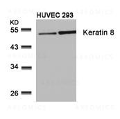 Anti-Keratin 8 (Ab-74)