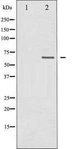 Anti-NF2