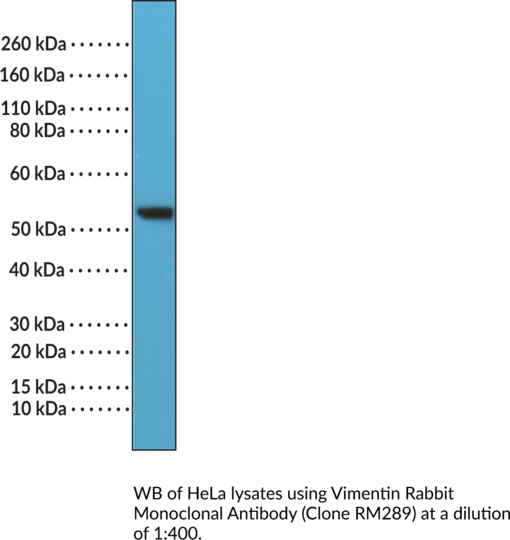 Anti-Vimentin Rabbit (Clone RM289)