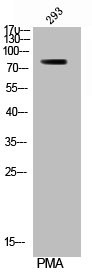 Anti-Phospho-RPS6KA1 (S380)