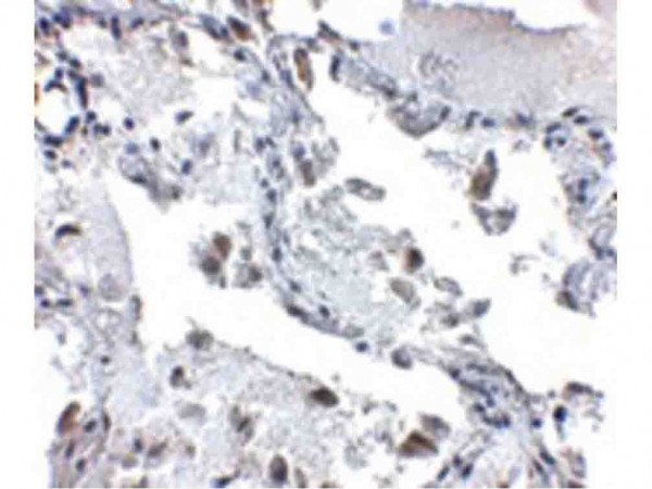 Anti-SH3BP4