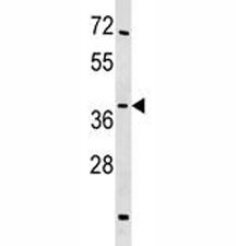 Anti-SIRT4