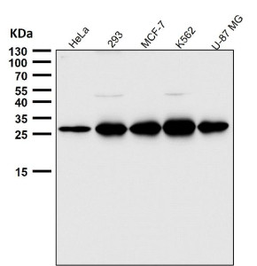 Anti-PDGFB / Platelet derived growth factor subunit B, clone 31P34