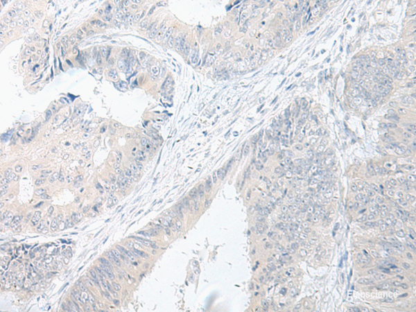 Anti-GPRASP2