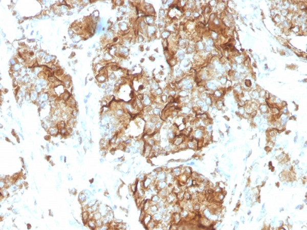 Anti-Carcinoembryonic Antigen (CEA) / CD66, clone SPM584