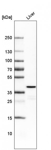 Anti-OTC, clone CL4049