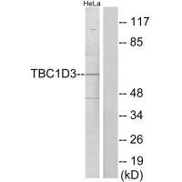 Anti-TBC1D3