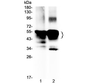 Anti-Retinal S antigen / SAG