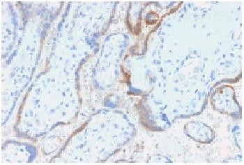 Anti-HCG-beta (Pregnancy &amp; Choriocarcinoma Marker) Recombinant Mouse Monoclonal Antibody (clone:rHCG