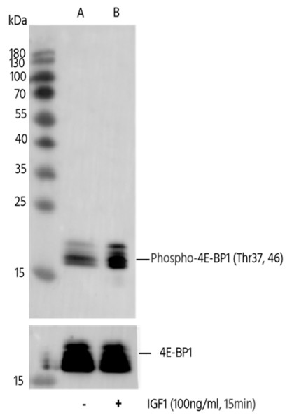 Anti-Phospho-4E-BP1 (Thr37, 46) Monoclonal Recombinant Antibody