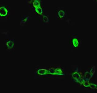 Anti-ATP5B