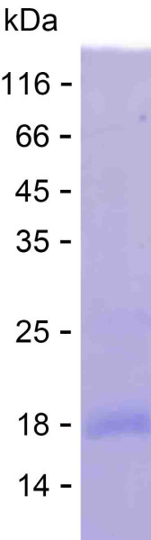 Recombinant Human PYGO2 Protein