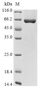 Coiled-coil domain-containing protein 112 (CCDC112), human, recombinant