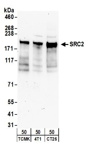 Anti-NCOA2/SRC2