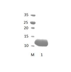 FRMPD1 PDZ Domain