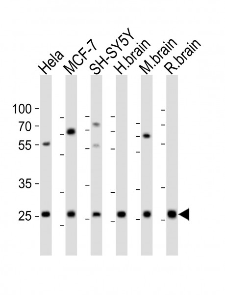Anti-Neurotrophin 3