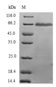 Dehydrodolichyl diphosphate synthase (DHDDS), human, recombinant