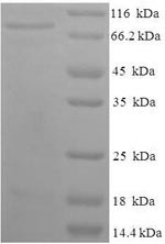 Dihydropyrimidinase-related protein 1 (CRMP1), human, recombinant