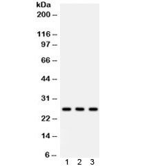 Anti-SFTPA1/2