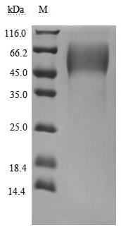 Mucin-16 (MUC16), partial (Active), human, recombinant