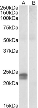 Anti-HMGA1 (aa9-21), Internal (near N-term)