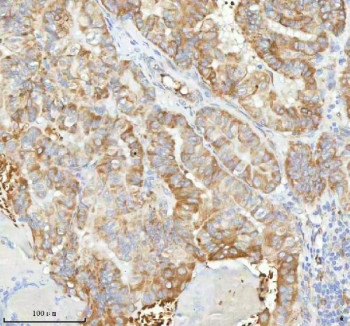 Anti-HAGH / Hydroxyacylglutathione hydrolase