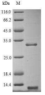 Oligodendrocyte transcription factor 1 (OLIG1), partial, human, recombinant
