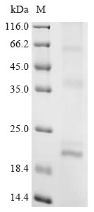 Claudin-5 (Cldn5), rat, recombinant