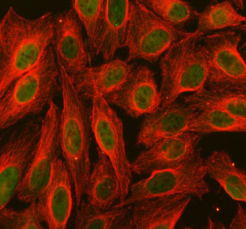 Anti-PDCD2 / Programmed cell death protein 2
