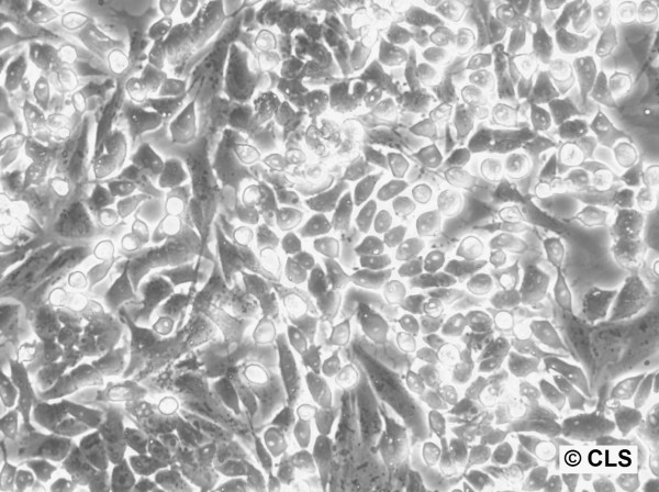PCC4-aza1 Cells