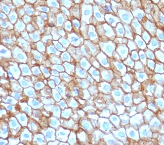 Anti-Desmoglein 3 / DSG3, clone CFM6-1