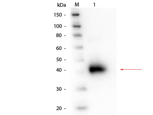 Anti-ALPHA-1-ACID GLYCOPROTEIN (Human Plasma)