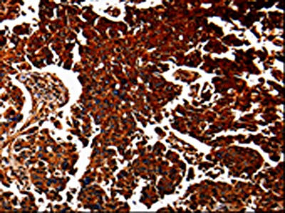 Anti-ANXA7