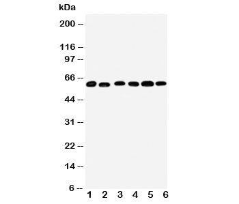 Anti-Monoamine Oxidase B