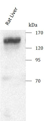 Anti-NAA16