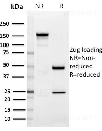 Anti-SIGLEC1 / CD169 / Sialoadhesin Monoclonal Antibody (Clone: HSn 7D2)