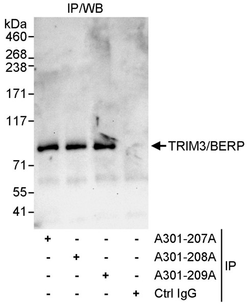 Anti-TRIM3/BERP