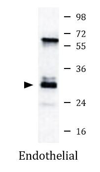 Anti-Calcipressin 1